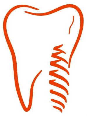 Implant Sentr